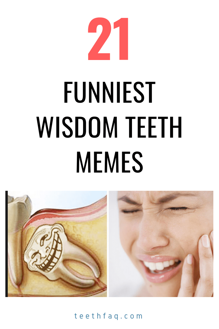 funny-teeth-captions-for-instagram